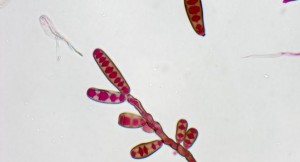 Hongo meningitis photo-exserohilum_960px
