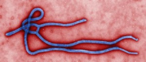 virus-del-ebola-al-microscopio_66398