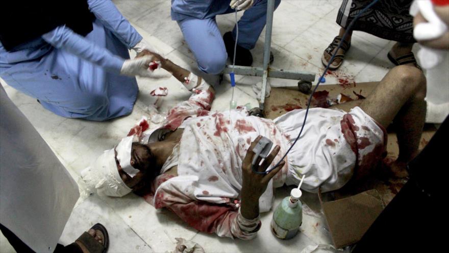 Un hombre herido durante los bombardeos saudíes contra Yemen recibe atención médica en un hospital.