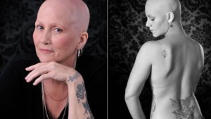 cancer-fotografia-cancer-leucemia-terri-shaver