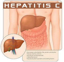 Hepatitis c sovaldi gilead
