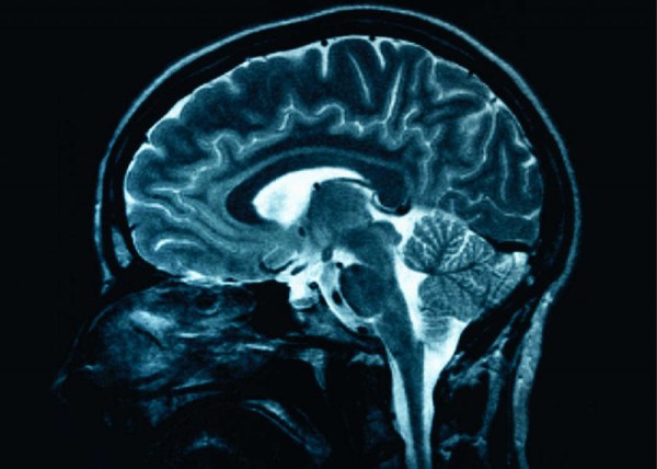 Cerebro humano