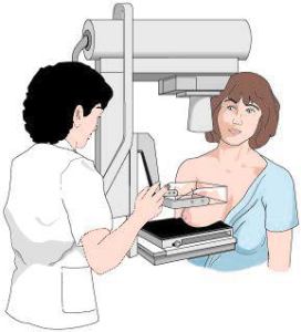 mamografía cáncer mama