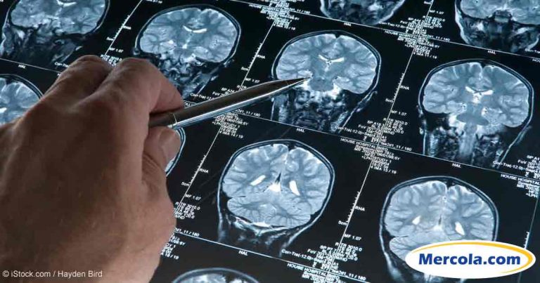 brain-scan-logo-fb