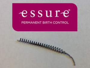 essure3