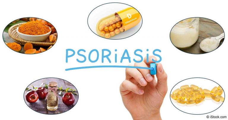 foods-for-psoriasis-fb