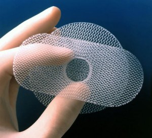 Mallas vaginales
