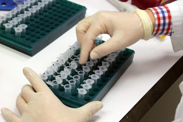El reto de financiar los fármacos huérfanos de terapia génica