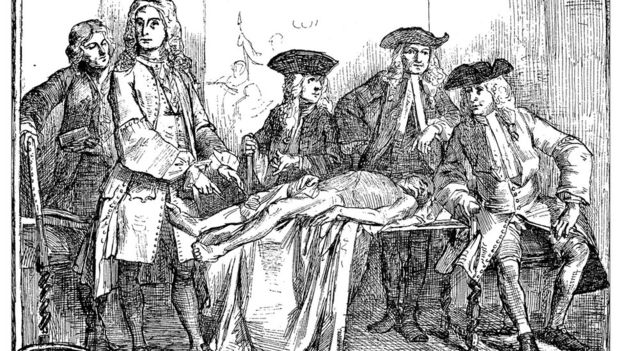 Ilustración de una operación antigua