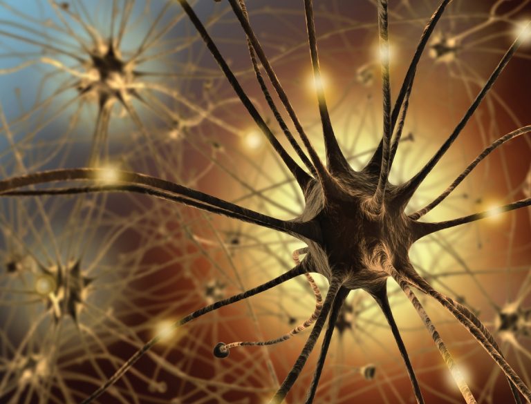 Alzheimer
