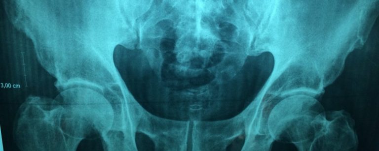 doctor_x_ray_hospital_physician_scan_film_examination_diagnosis-637586.jpgd_