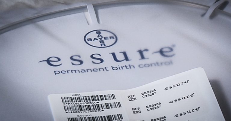 essure
