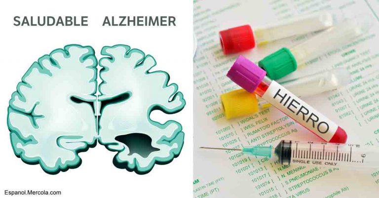 como-el-exceso-de-hierro-aumenta-su-riesgo-de-alzheimer-1-fb