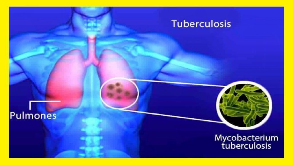 nuevo medicamento para la tuberculosis