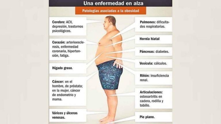 cropped-20190908obesidadargentinainfografiagpgjpg-776253.jpg