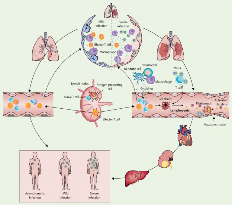 sepsis-viral
