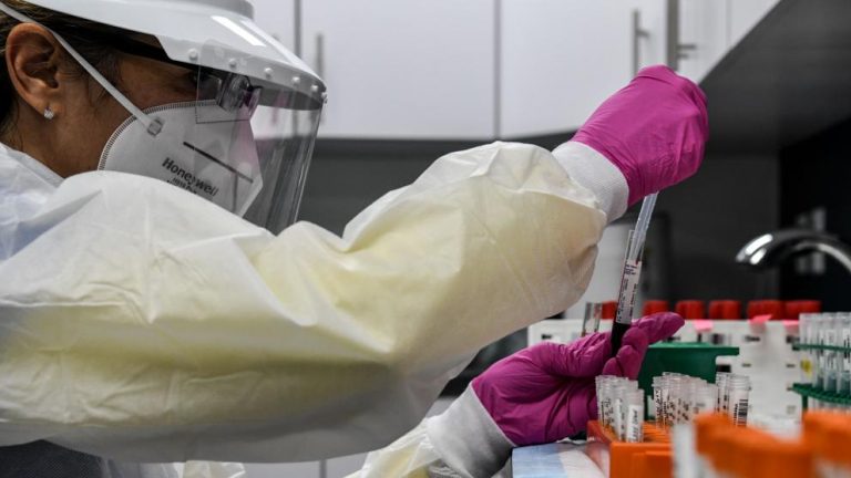 laboratorio covid