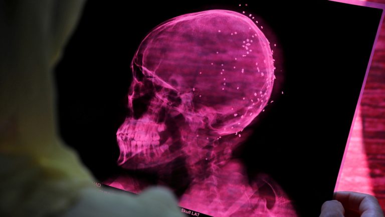 cerebro covid
