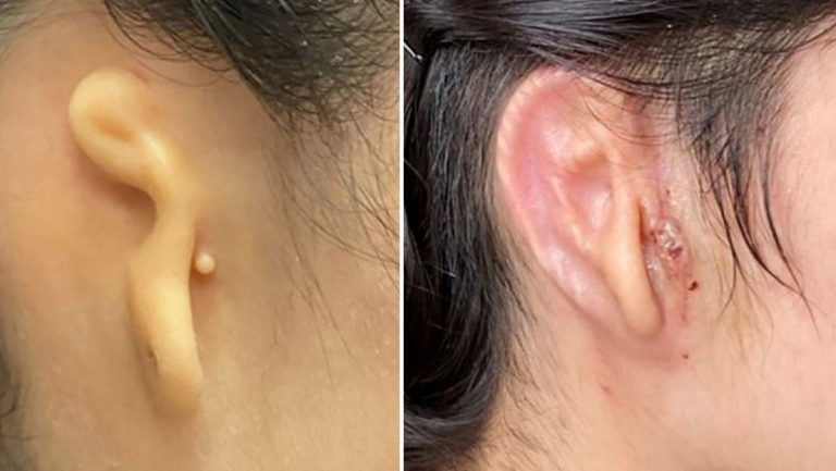 oreja