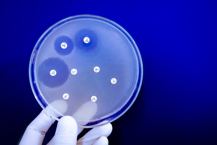Antimicrobial susceptibility testing in petri dish. Antibiotic resistance of bacteria